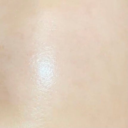 トレチノインジェル/A-Ret/美容液を使ったクチコミ(1枚目)