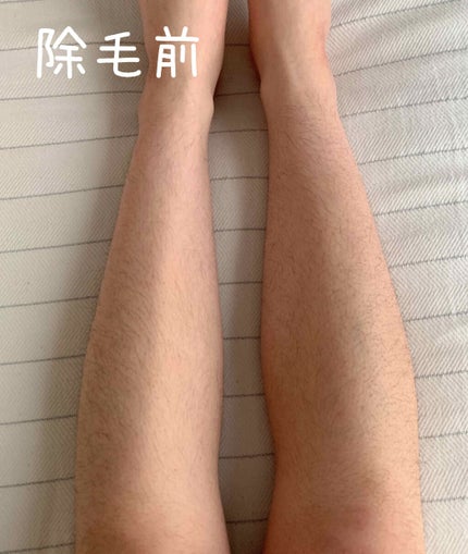 除毛クリーム(敏感肌用)/Veet/除毛クリームを使ったクチコミ(2枚目)