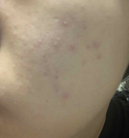 ミノン アミノモイスト モイストチャージ ミルク/ミノン/乳液を使ったクチコミ(2枚目)