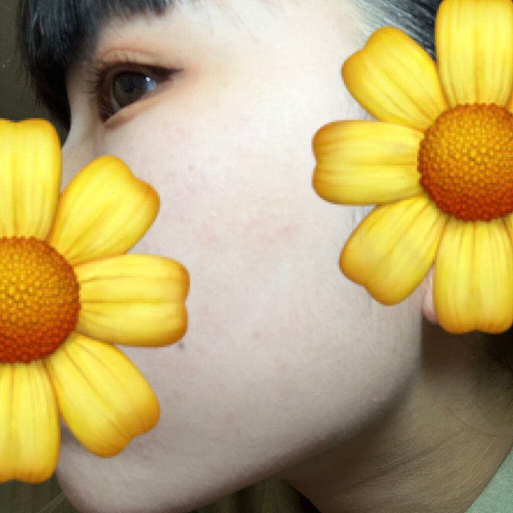 ハトムギ化粧水(ナチュリエ スキンコンディショナー R )/ナチュリエ/化粧水を使ったクチコミ(8枚目)