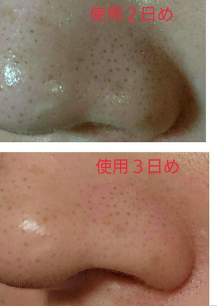LUNA mini2/FOREO/美顔器・マッサージを使ったクチコミ(2枚目)