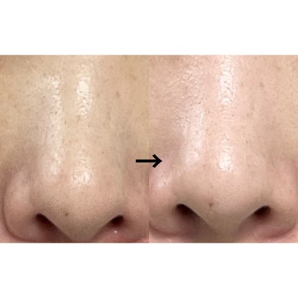 角質スッキリ毛穴パック /HANYUL(ハンユル)/洗い流すパック・マスクを使ったクチコミ(3枚目)