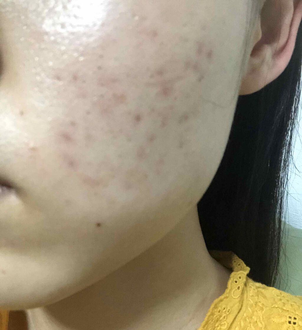 オリーブヤング ケアプラス/Olive Young/その他を使ったクチコミ（2枚目）