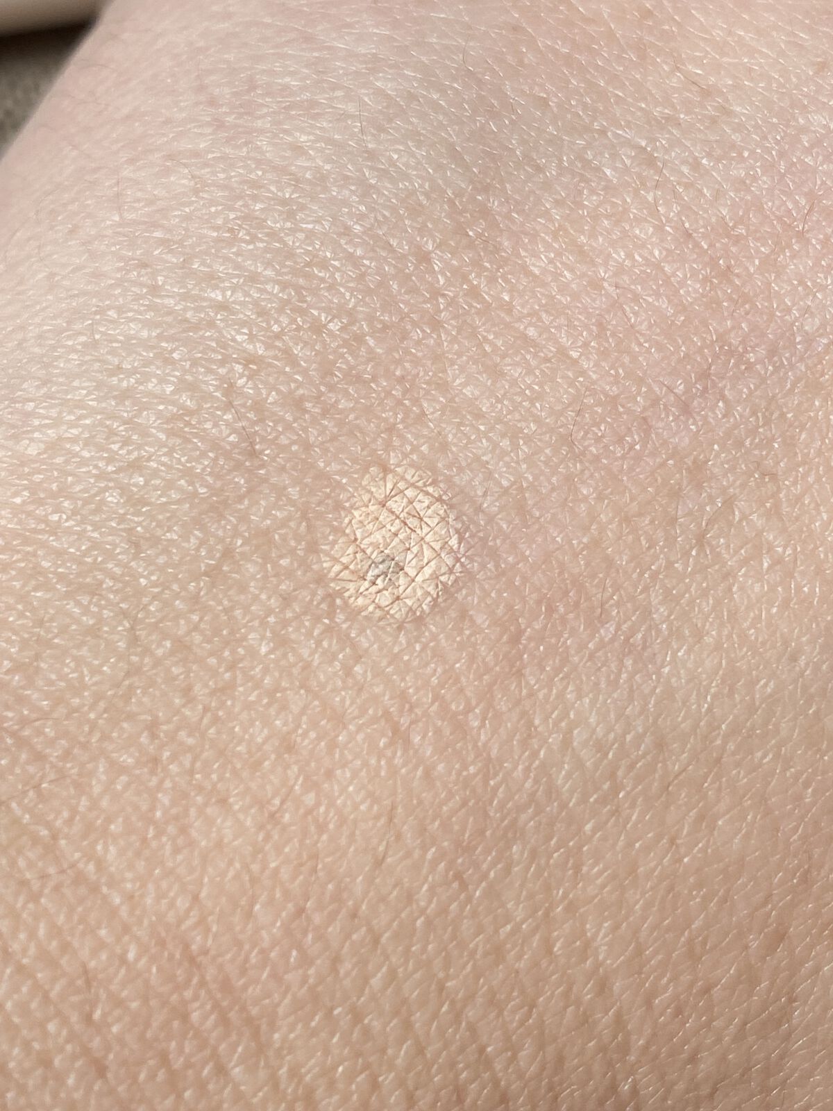 ポイントコンシーラー/CipiCipi/ペンシルコンシーラーを使ったクチコミ（3枚目）