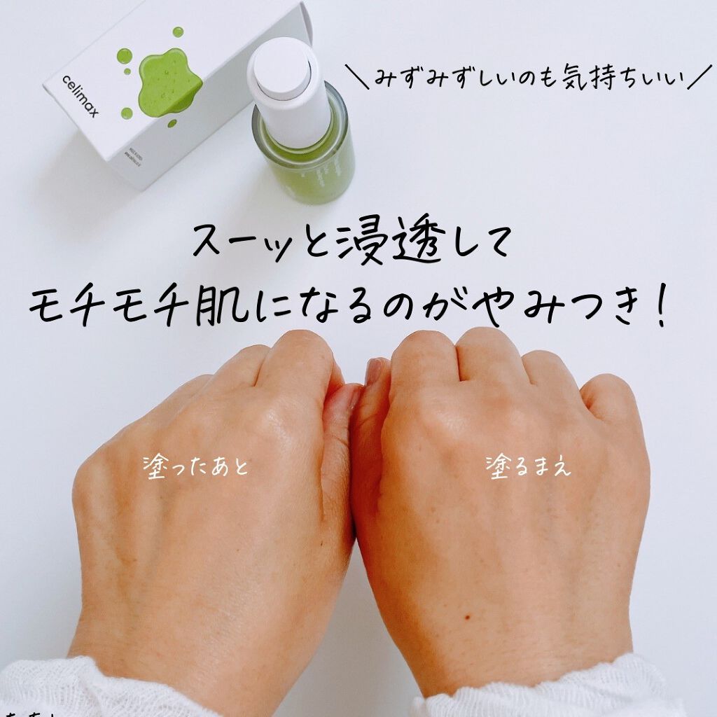 Noni Ampule/celimax/美容液を使ったクチコミ(6枚目)