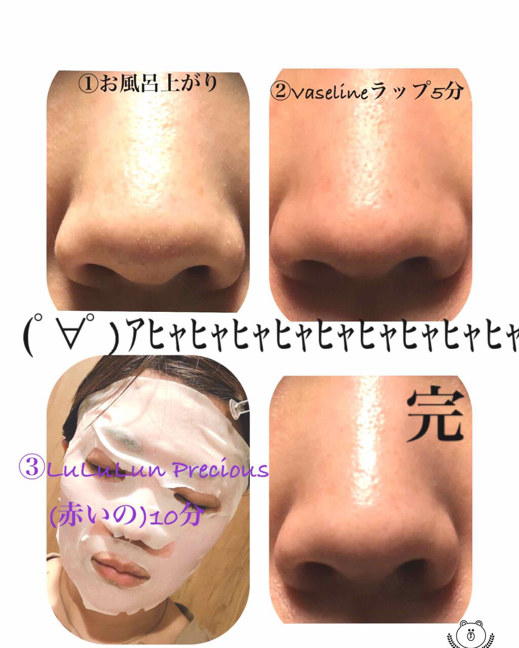 オリジナル ピュアスキンジェリー/ヴァセリン/ボディクリームを使ったクチコミ（2枚目）