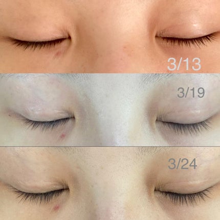 EMAKED(エマーキット)/水橋保寿堂製薬/まつげ美容液を使ったクチコミ(2枚目)