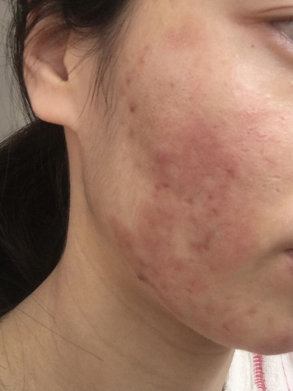 ドクタージャルト シカペアセラム	/Dr.Jart＋/美容液を使ったクチコミ（1枚目）