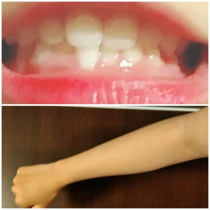 プレミアム ステインクリア ペースト/オーラツー/歯磨き粉を使ったクチコミ(3枚目)