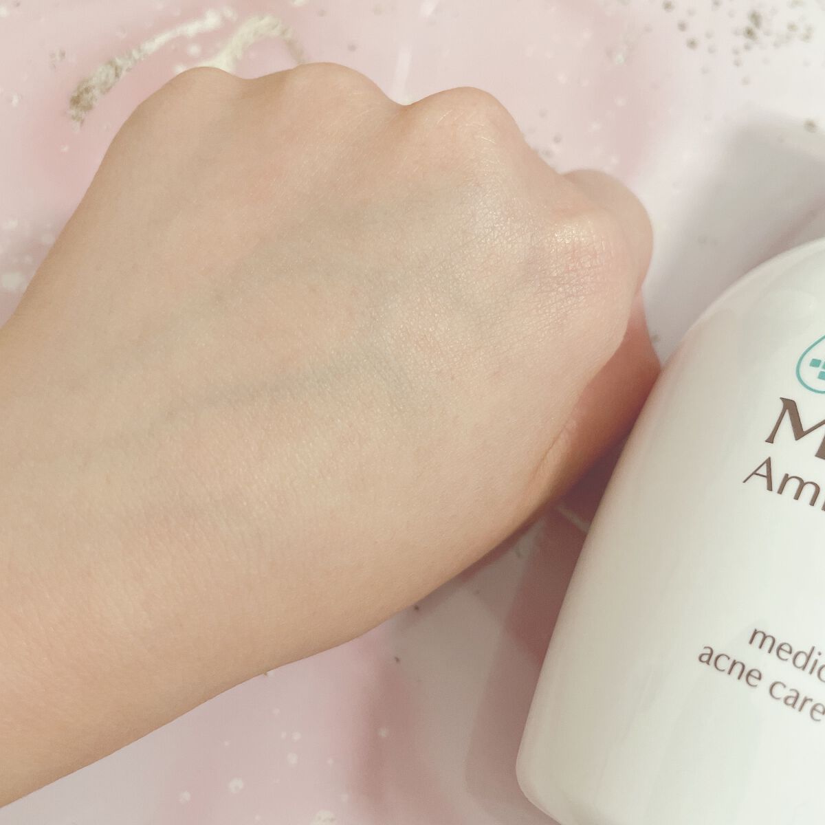 ミノン アミノモイスト 薬用アクネケア ローション/ミノン/化粧水を使ったクチコミ（3枚目）