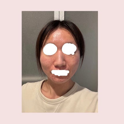 クリアエッセンスマスク/ピュレア/シートマスク・パックを使ったクチコミ(3枚目)