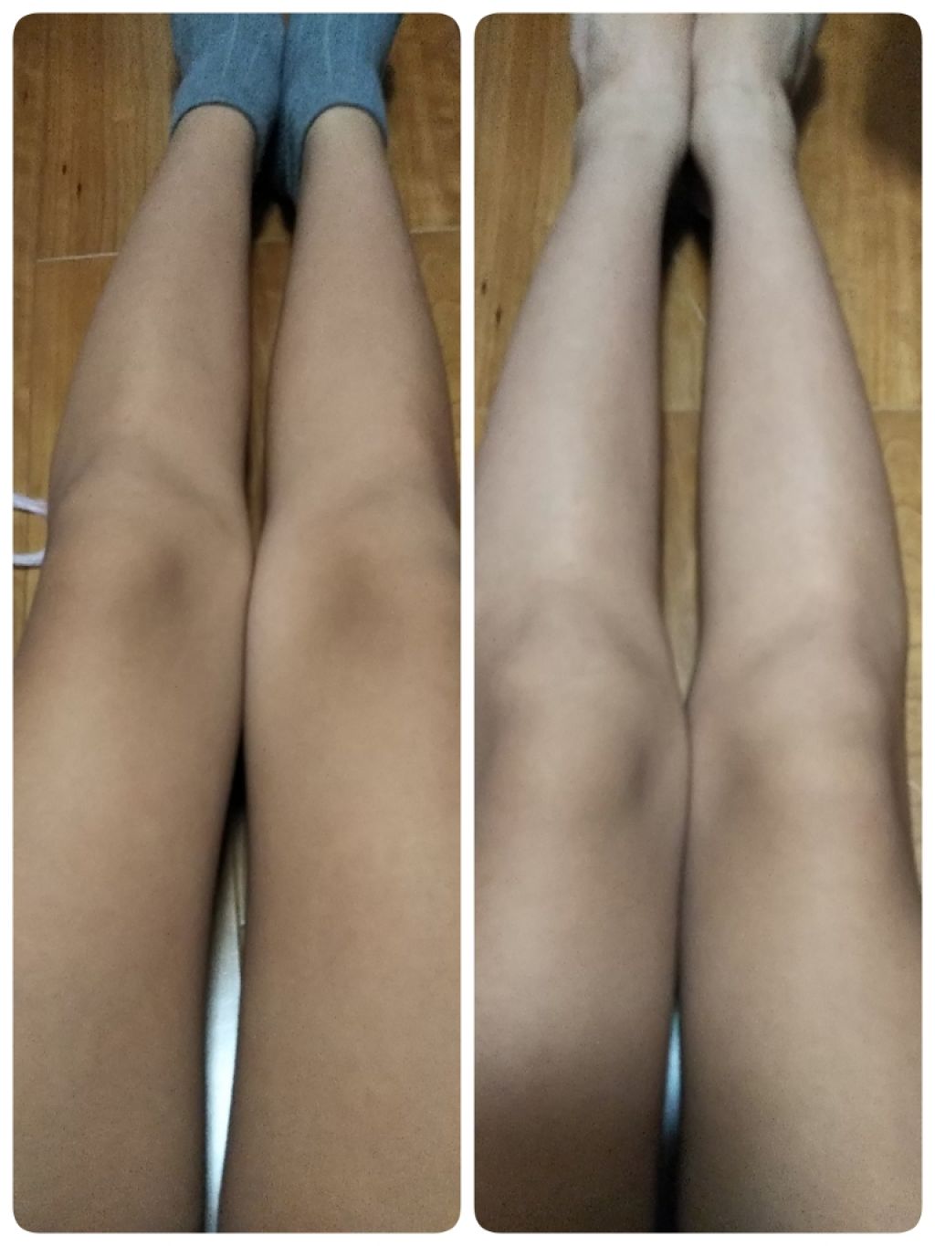 ニベアクリーム/ニベア/ボディクリームを使ったクチコミ（1枚目）