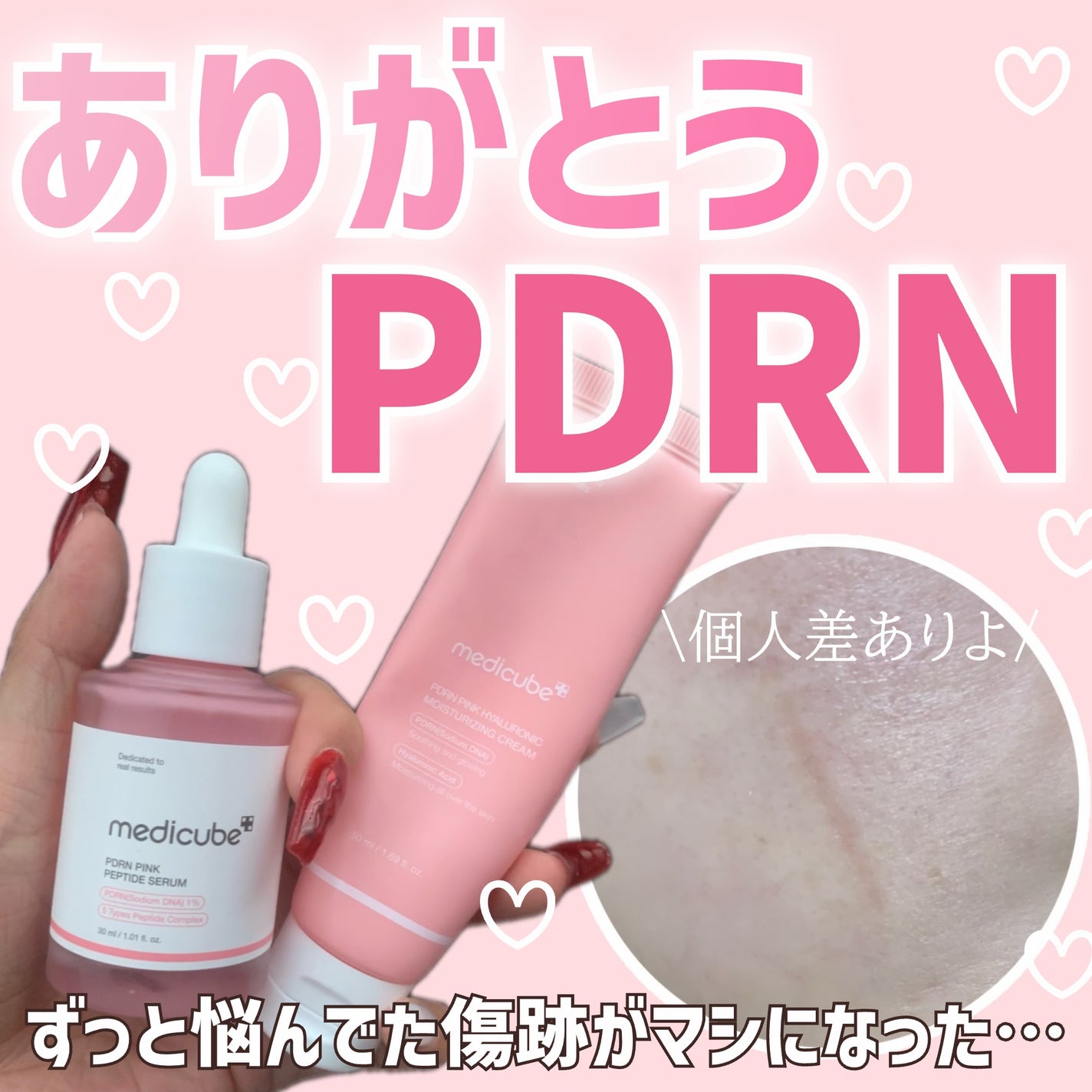 PDRNピンクアンプル PDRN 10,000ppm配合/MEDICUBE/美容液を使ったクチコミ(1枚目)