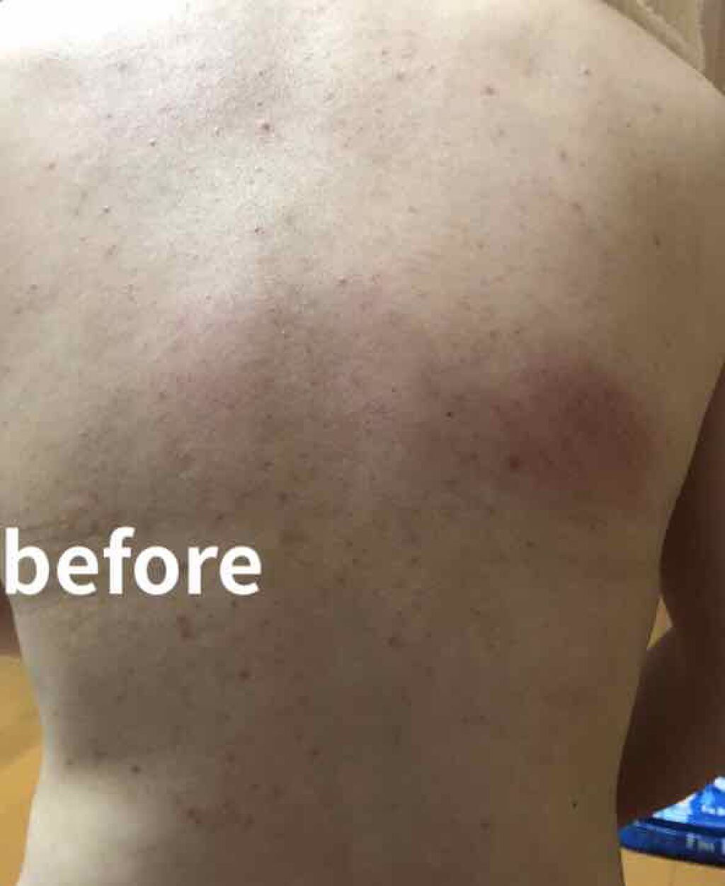 ふきとり化粧水/ちふれ/拭き取り化粧水を使ったクチコミ（2枚目）