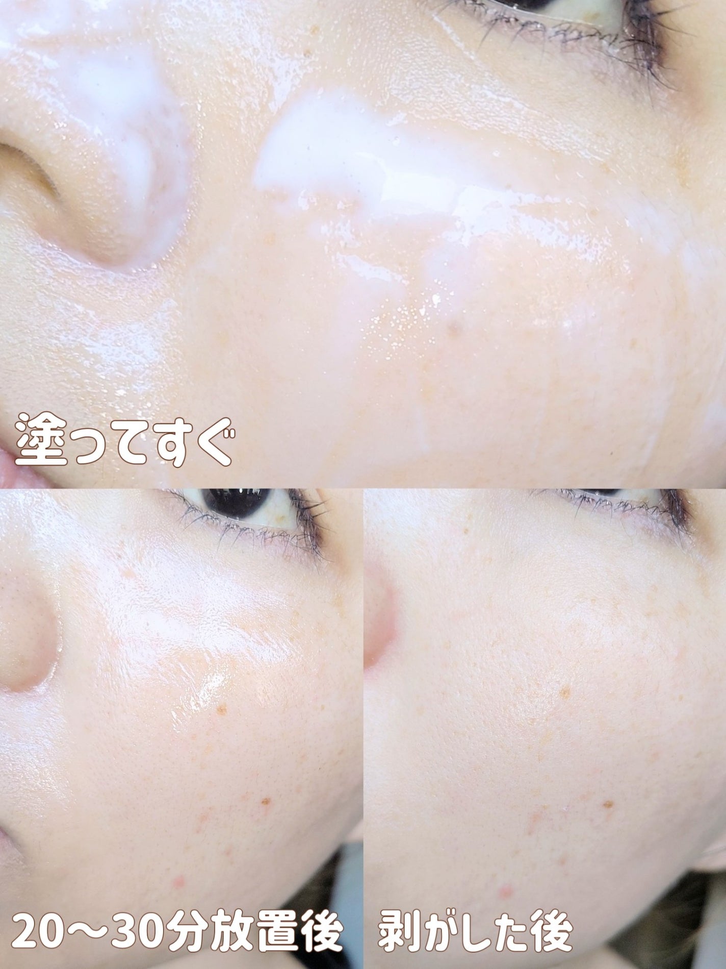 ピールオフクリーム/Bamboni/洗い流すパック・マスクを使ったクチコミ(5枚目)