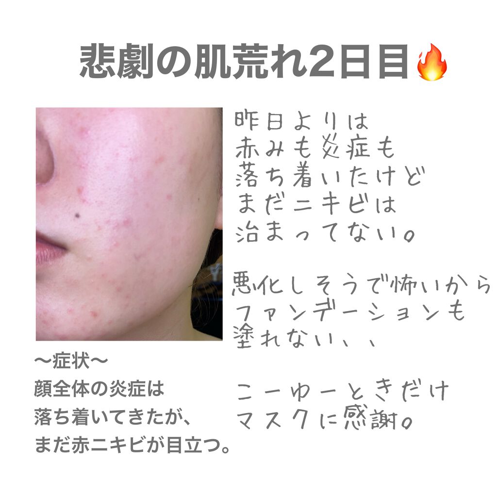明色美顔水 薬用化粧水/美顔/化粧水を使ったクチコミ（2枚目）