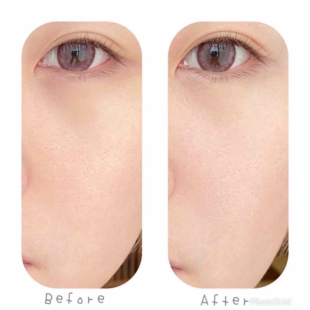 フィックス イット カラー/Dior/スティックコンシーラーを使ったクチコミ（2枚目）