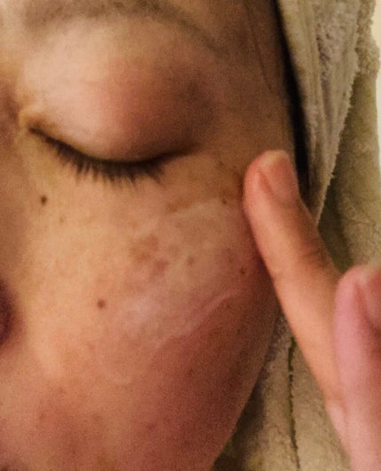 薬用リンクルクリーム/50の恵/フェイスクリームを使ったクチコミ(4枚目)