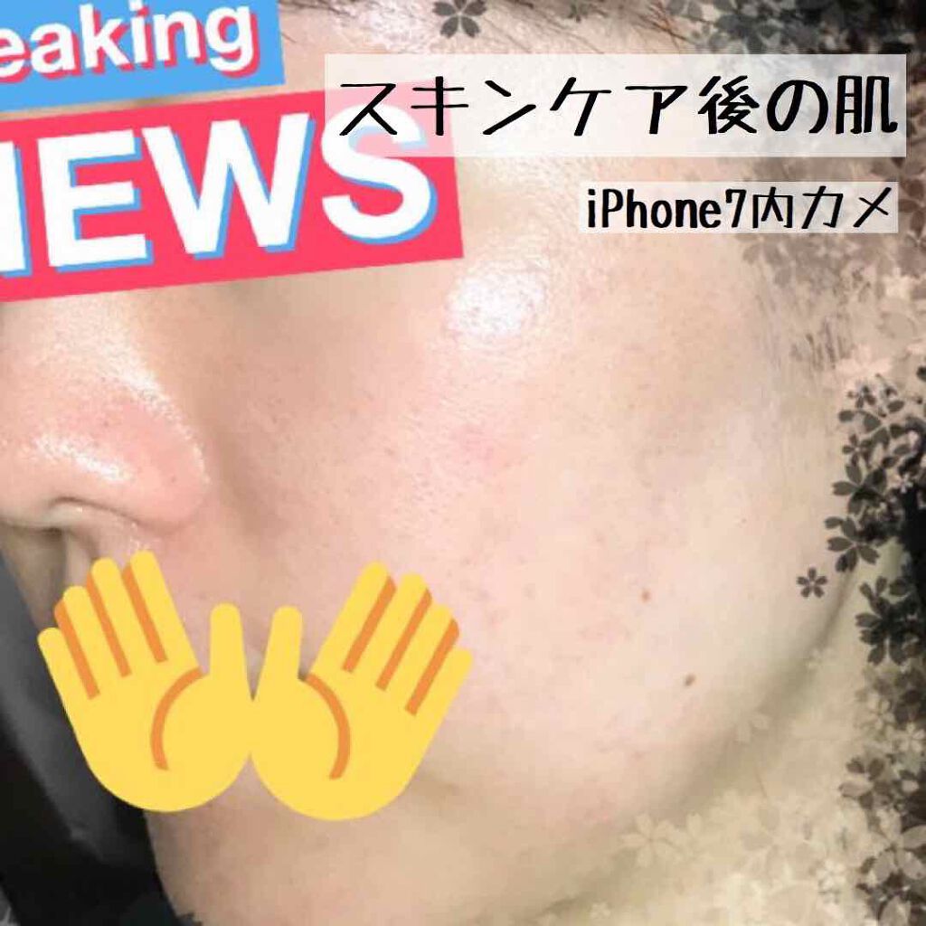 AC フェイスローション/NOV/化粧水を使ったクチコミ(2枚目)