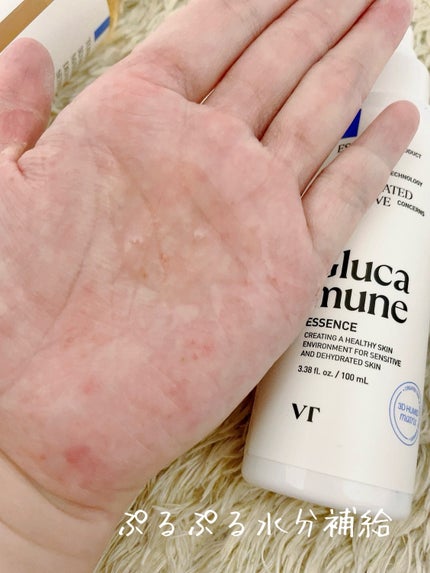 グルカミューンエッセンス /VT/美容液を使ったクチコミ(3枚目)