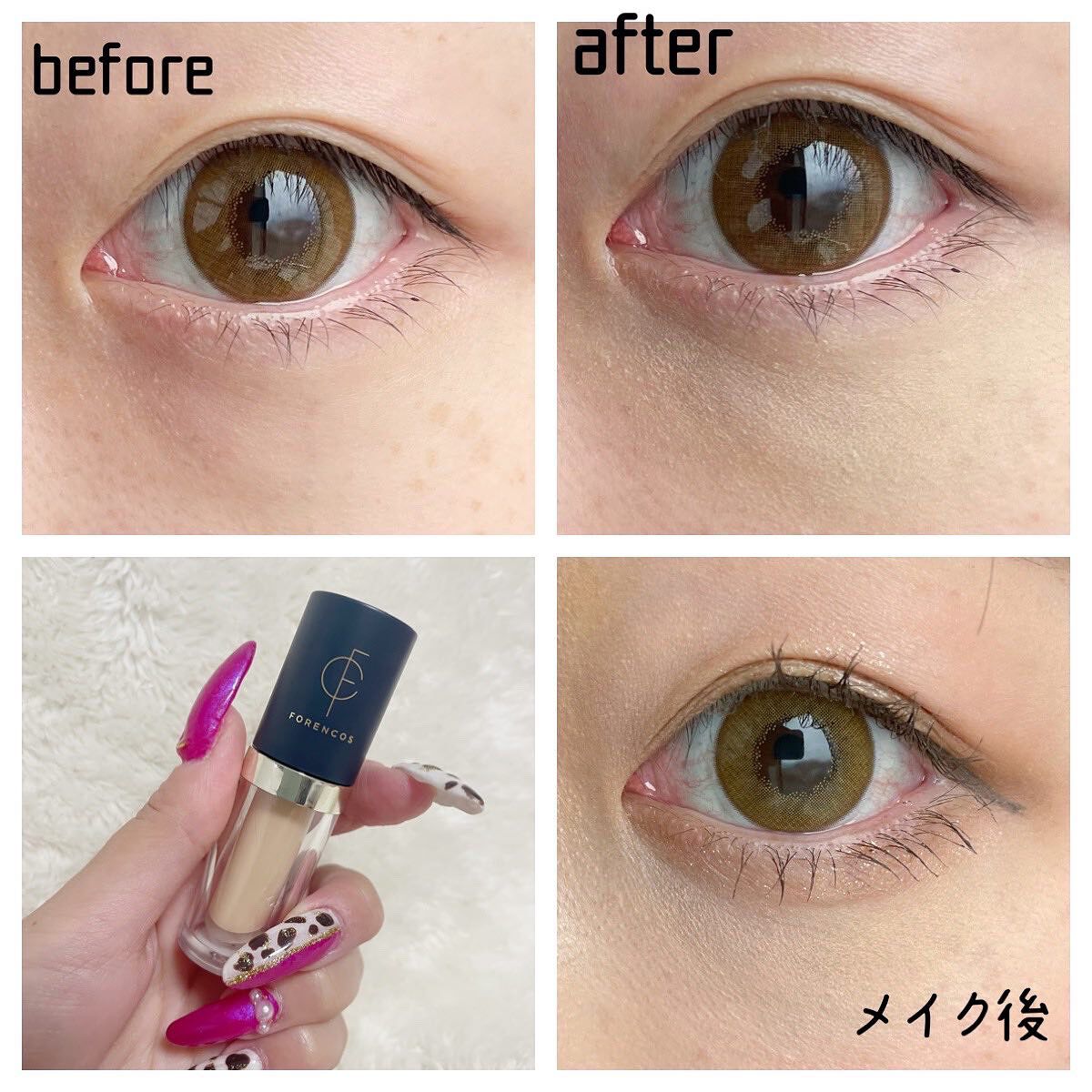 タトゥーウォータープルーフスカーコンシーラー/フォレンコス/リキッドコンシーラーを使ったクチコミ(5枚目)