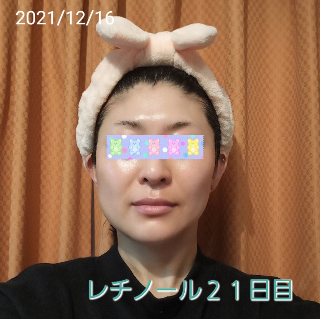 トレチノインジェル/A-Ret/美容液を使ったクチコミ(1枚目)