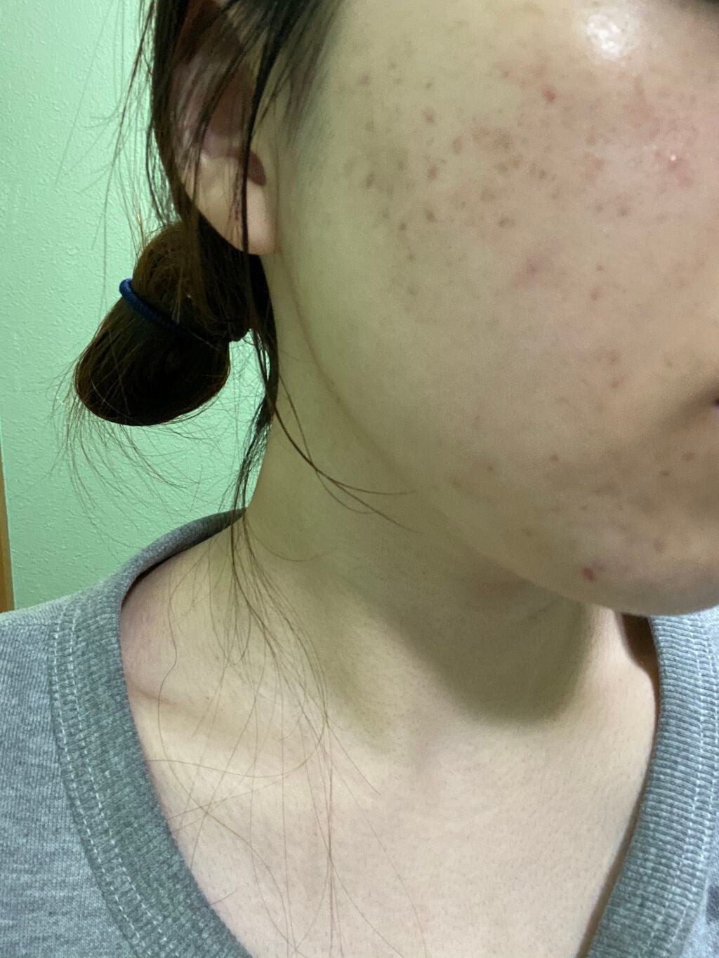 ホットクレンジングゲル/マナラ/クレンジングジェルを使ったクチコミ(2枚目)