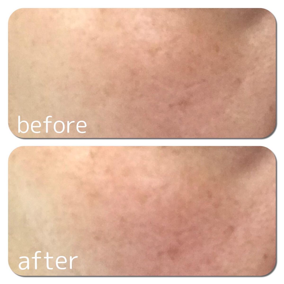 ホワイトニングクリーム/サイクレアー/フェイスクリームを使ったクチコミ（3枚目）