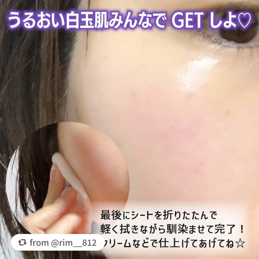 ルルルン ハイドラ EX マスク/ルルルン/シートマスク・パックを使ったクチコミ(6枚目)