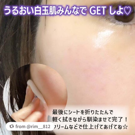 ルルルン ハイドラ EX マスク/ルルルン/シートマスク・パックを使ったクチコミ(6枚目)