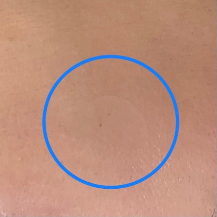 Chane on LIPS 「株式会社金冠堂さまより頂きました。【ニキパ!】ニキビの跡気にな..」(5枚目)