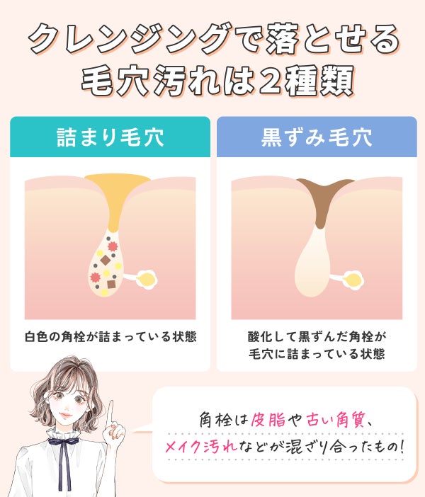 クレンジングで落とせる毛穴汚れは2種類。詰まり毛穴は白色の角栓が詰まっている状態。黒ずみ毛穴は酸化して黒ずんだ角栓が毛穴に詰まっている状態。角栓は皮脂や古い角質、メイク汚れなどが混ざり合ったもの!