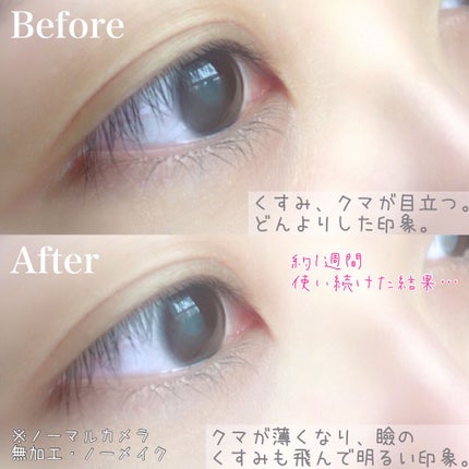 コレクティブアイセラム/shimaboshi/アイケア・アイクリームを使ったクチコミ(4枚目)