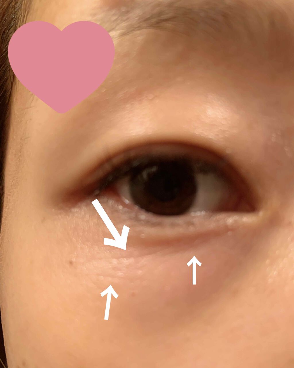 リンクル リペアリフト/ALBION/アイケア・アイクリームを使ったクチコミ（2枚目）