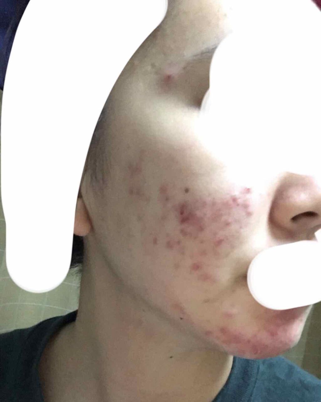 ハトムギ保湿ジェル(ナチュリエ スキンコンディショニングジェル)/ナチュリエ/美容液を使ったクチコミ(2枚目)