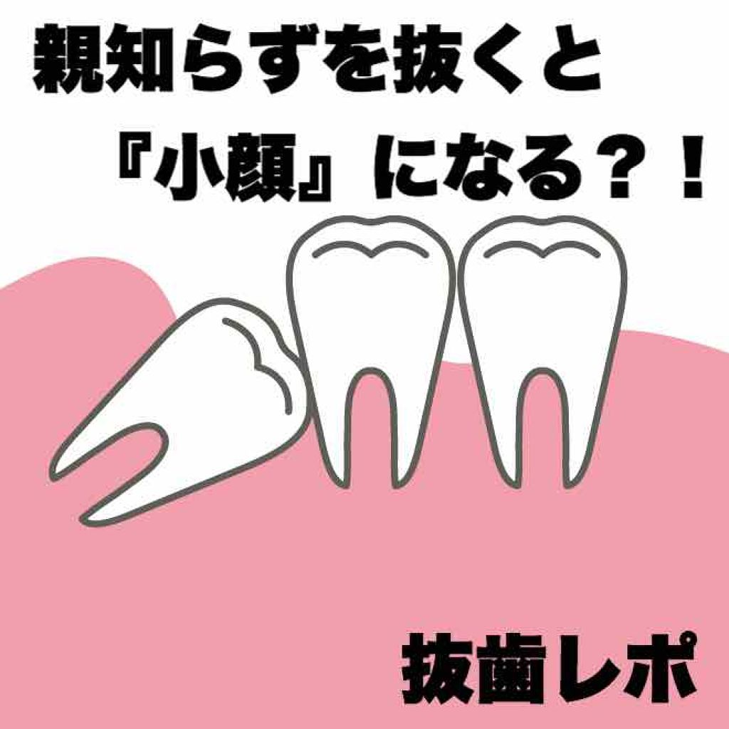 ジェルコートF/ウエルテック/その他オーラルケアを使ったクチコミ（1枚目）