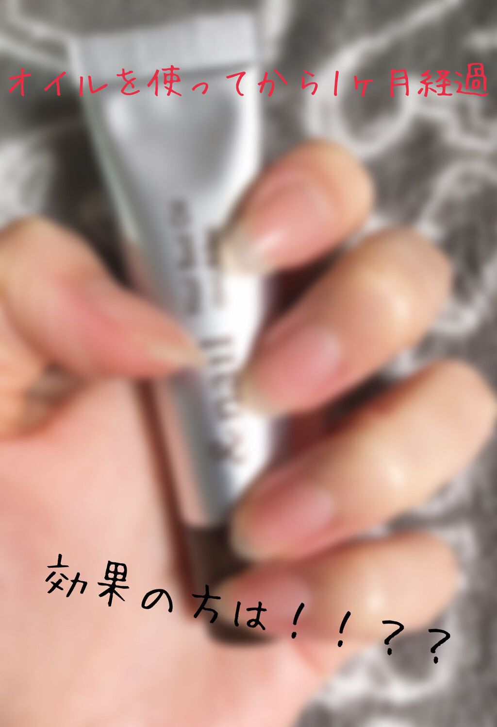 ネイルベッドオイル/アンドネイル/ネイルオイル・トリートメントを使ったクチコミ（1枚目）