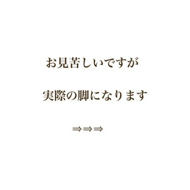 きゅあむーん☁*° on LIPS 「今回は私の脚やせ事情についてです。よく友達に細くなったと言われ..」（2枚目）