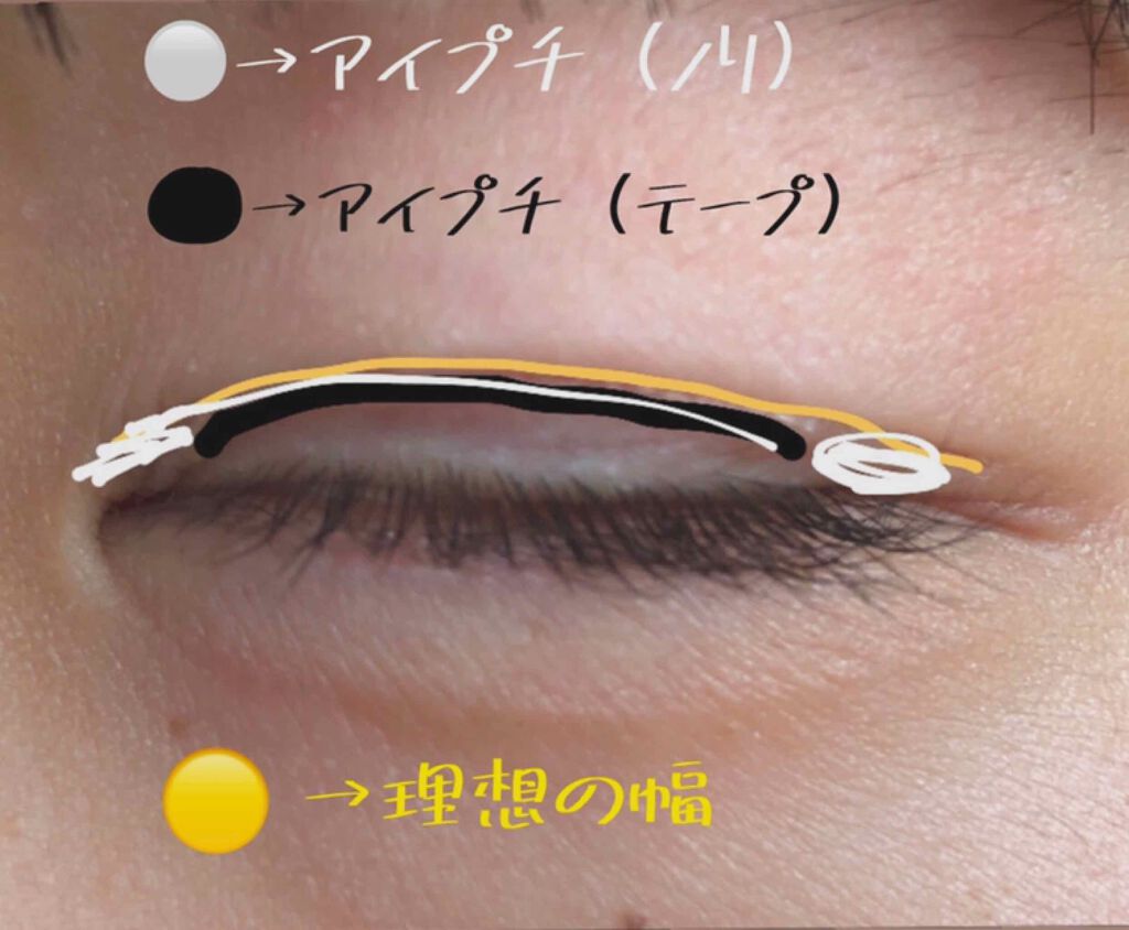 りんご on LIPS 「<欲張りすぎないで、奥二重さんのための絆創膏癖付け>こんにちは..」(2枚目)