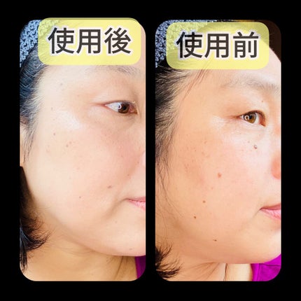 アンクル ド ポー ルクッションN/YVES SAINT LAURENT BEAUTE/クッションファンデーションを使ったクチコミ(2枚目)