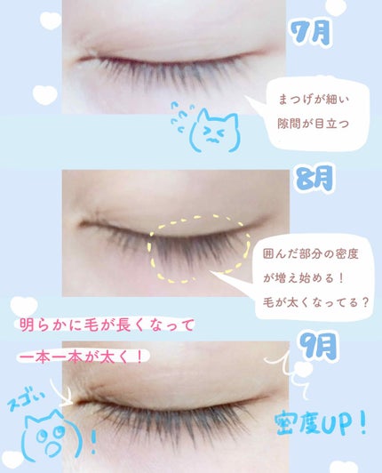 ローヤルゼリー配合 栄養ローション/DAISO/美容液を使ったクチコミ(2枚目)