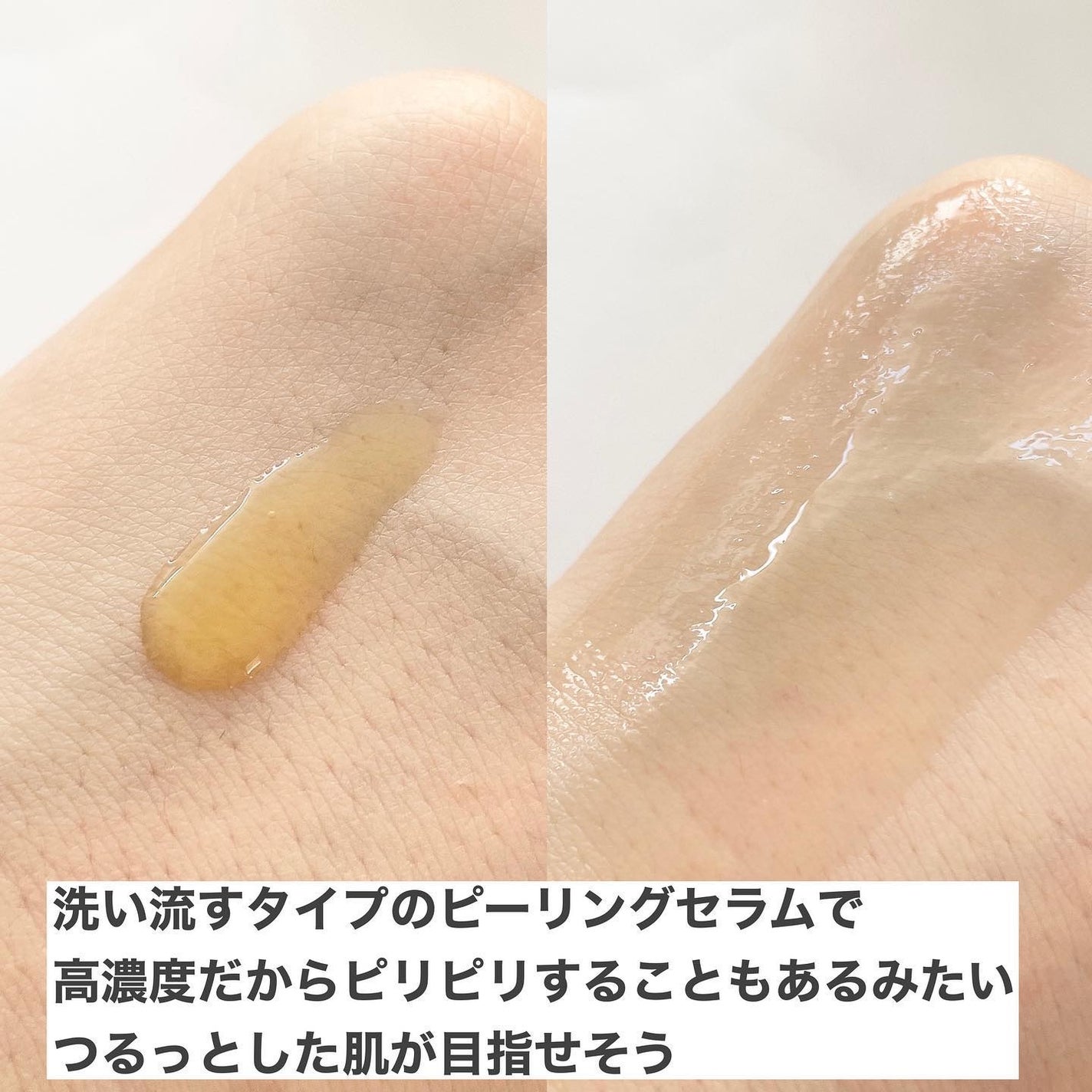 レッドアクネピーリングセラム/MEDICUBE/美容液を使ったクチコミ(5枚目)