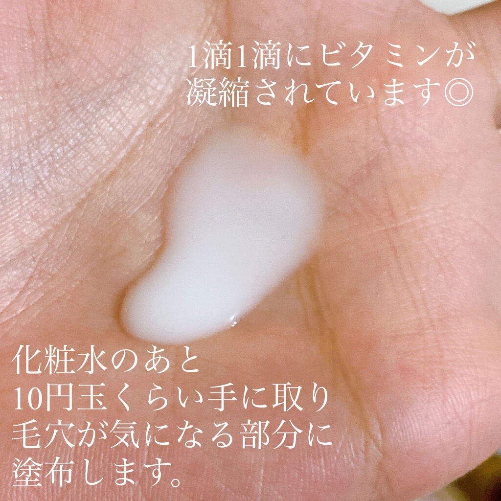 エンリッチCセラム/IGA LAB/美容液を使ったクチコミ(4枚目)