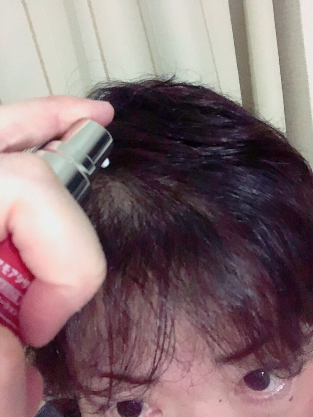 スカルプエッセンス｜ヘアモアの効果に関する口コミ - 髪のボリューム