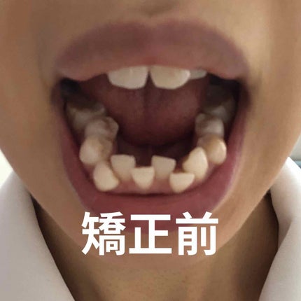 ããŠã¹ããŒã¹ç¯æ£/ãã®ä»ã䜿ã£ãã¯ãã³ãïŒ2æç®ïŒ