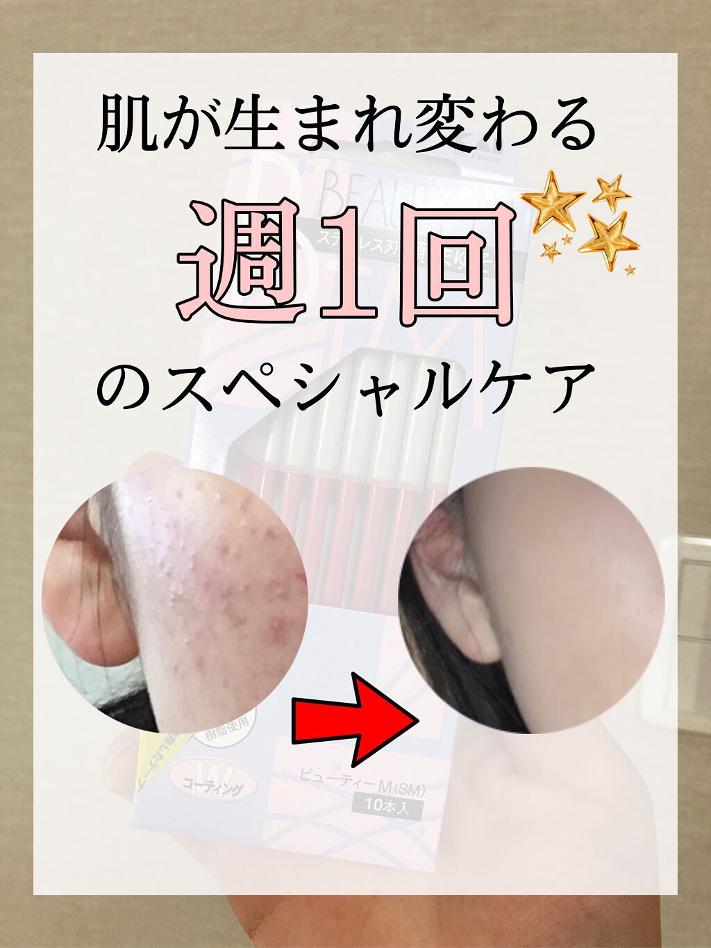 長柄カミソリ ビューティーM /貝印/シェーバーを使ったクチコミ（1枚目）