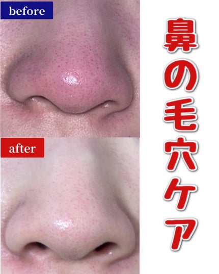 スペシャルパウダーソープCure/Cure/洗顔パウダーを使ったクチコミ(1枚目)