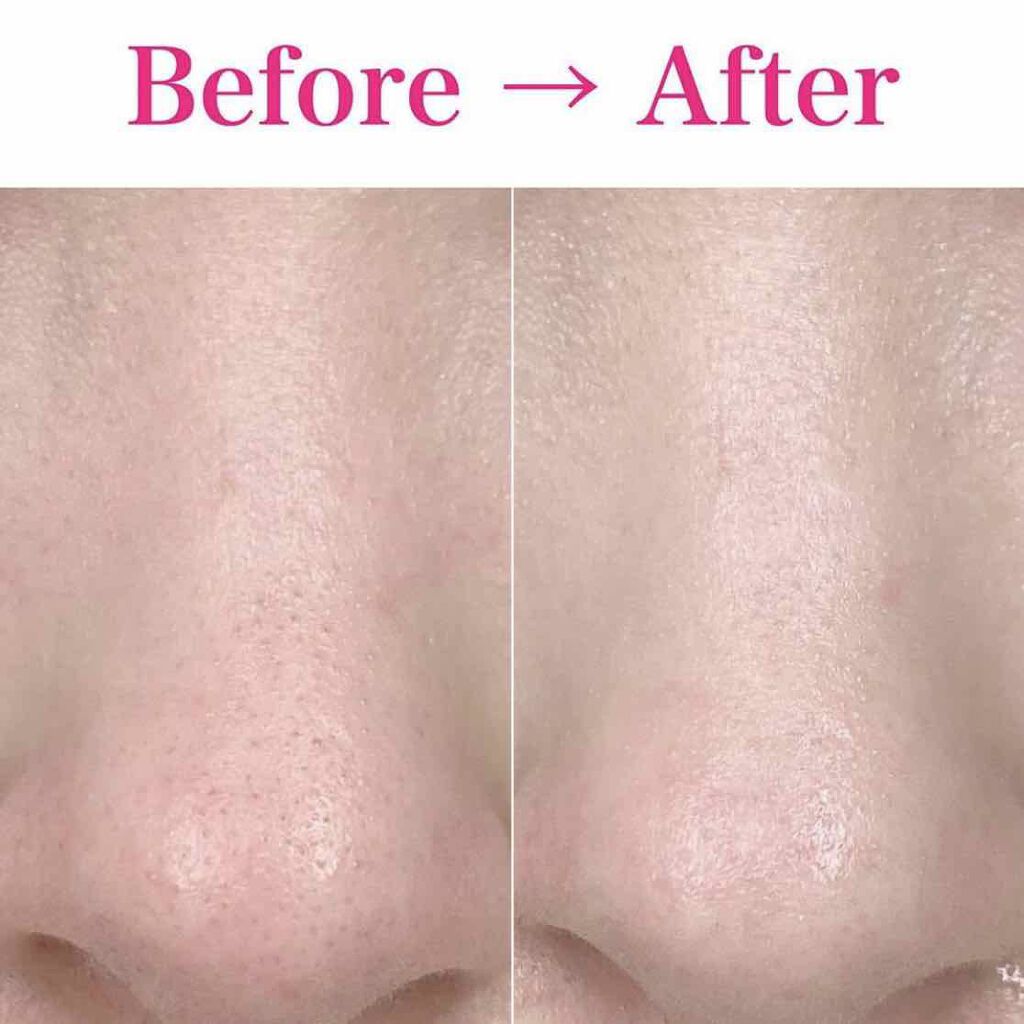 ブラック ヘッド ゼロ ２ステップ ノーズ パッチ/Dr.Althea/シートマスク・パックを使ったクチコミ（1枚目）