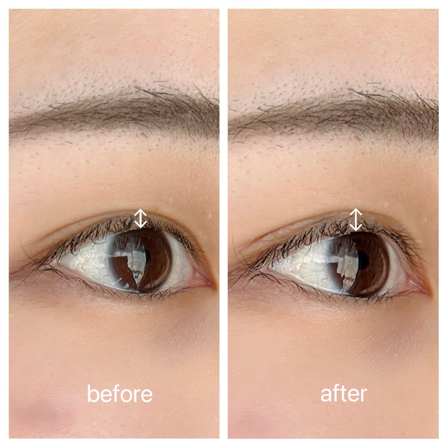 メザイク イージークリア 接着クリアタイプ/メザイク/二重まぶた用アイテムを使ったクチコミ(2枚目)