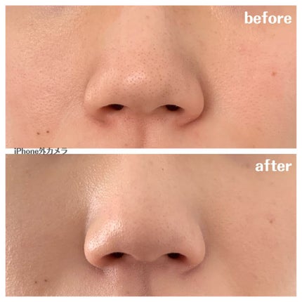 やな on LIPS 「わたしはファンデーションつけない派でした。普段の化粧は日焼け止..」(4枚目)